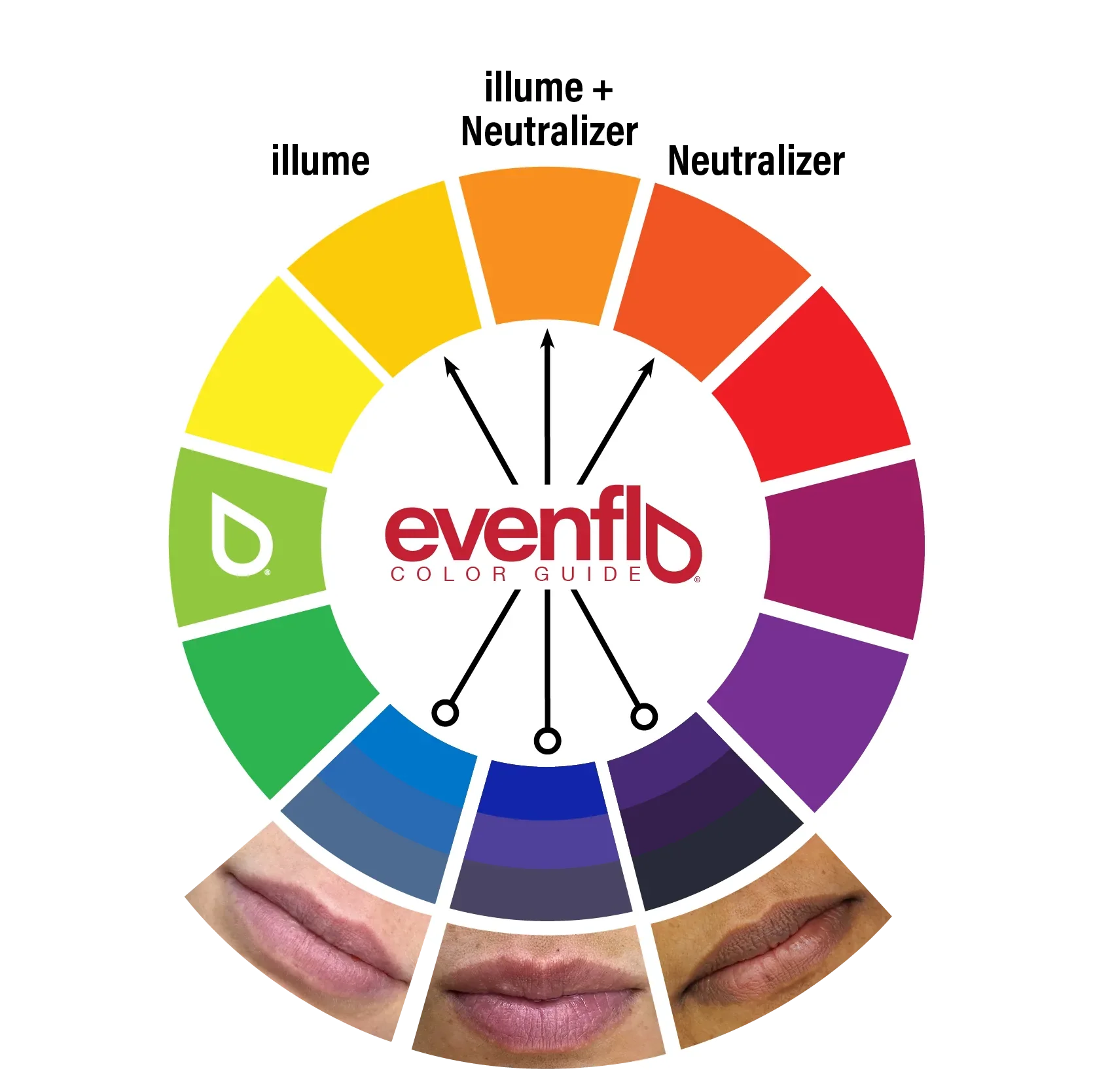 Evenflo Neutralizer Set — 3 1/2oz Bottles - Image 6